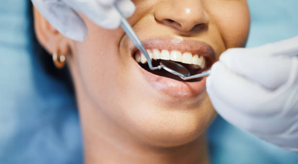Best Emergency Dental Filling Replacement  in Spencerville, NM